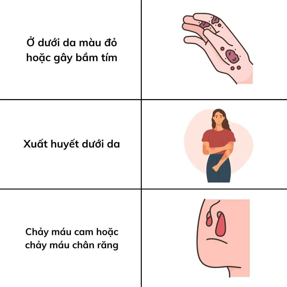 Có nên tắm gội khi bị sốt xuất huyết? 3 Các biểu hiện khi sốt xuất huyết