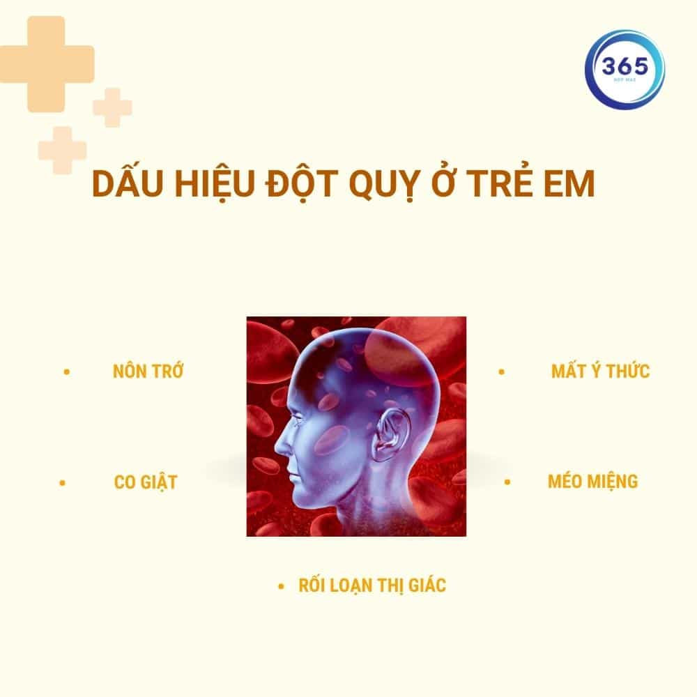 Dấu hiệu ban đầu khi trẻ nhỏ đột quỵ bạn nên biết 2 Dấu hiệu đột quỵ ở trẻ em các bố mẹ nên cần biết