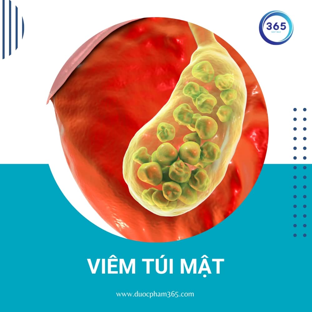 6 bệnh liên quan đến viêm đau dạ dày thường gặp 2 viem tui mat