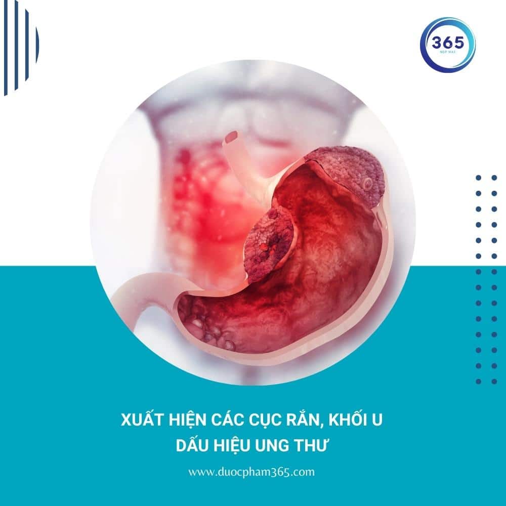 xuat hien cuc ran o bung