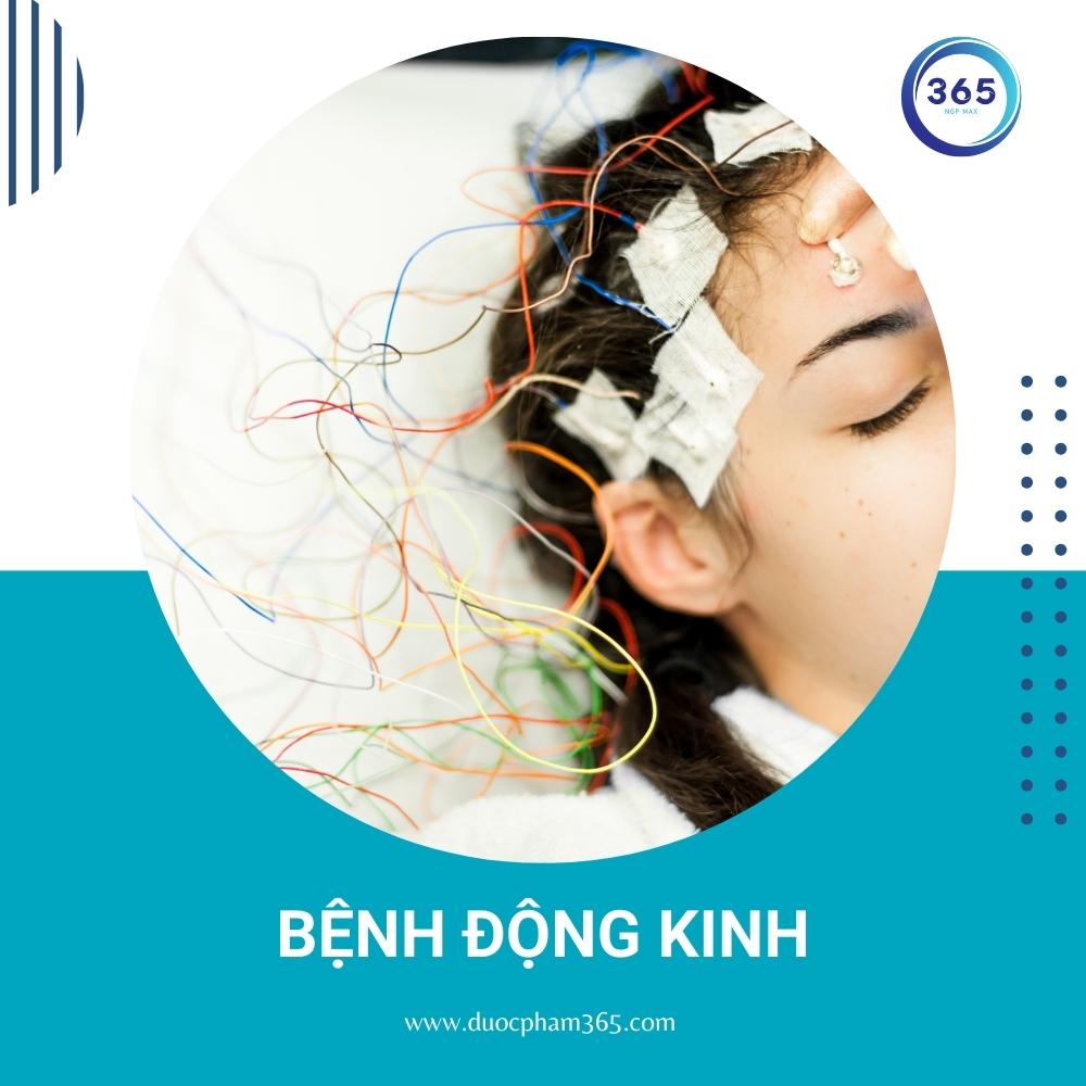 bi benh dong kinh