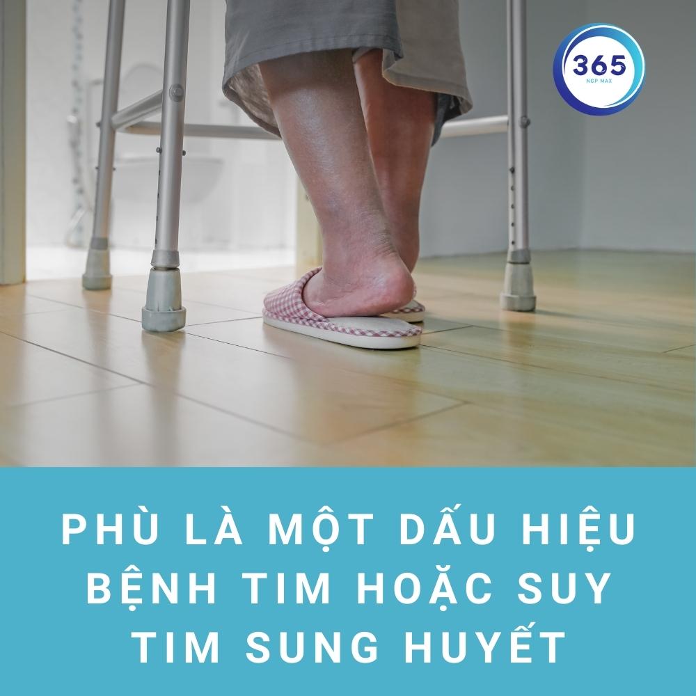 phù là biểu hiện giữ nước trong cơ thể