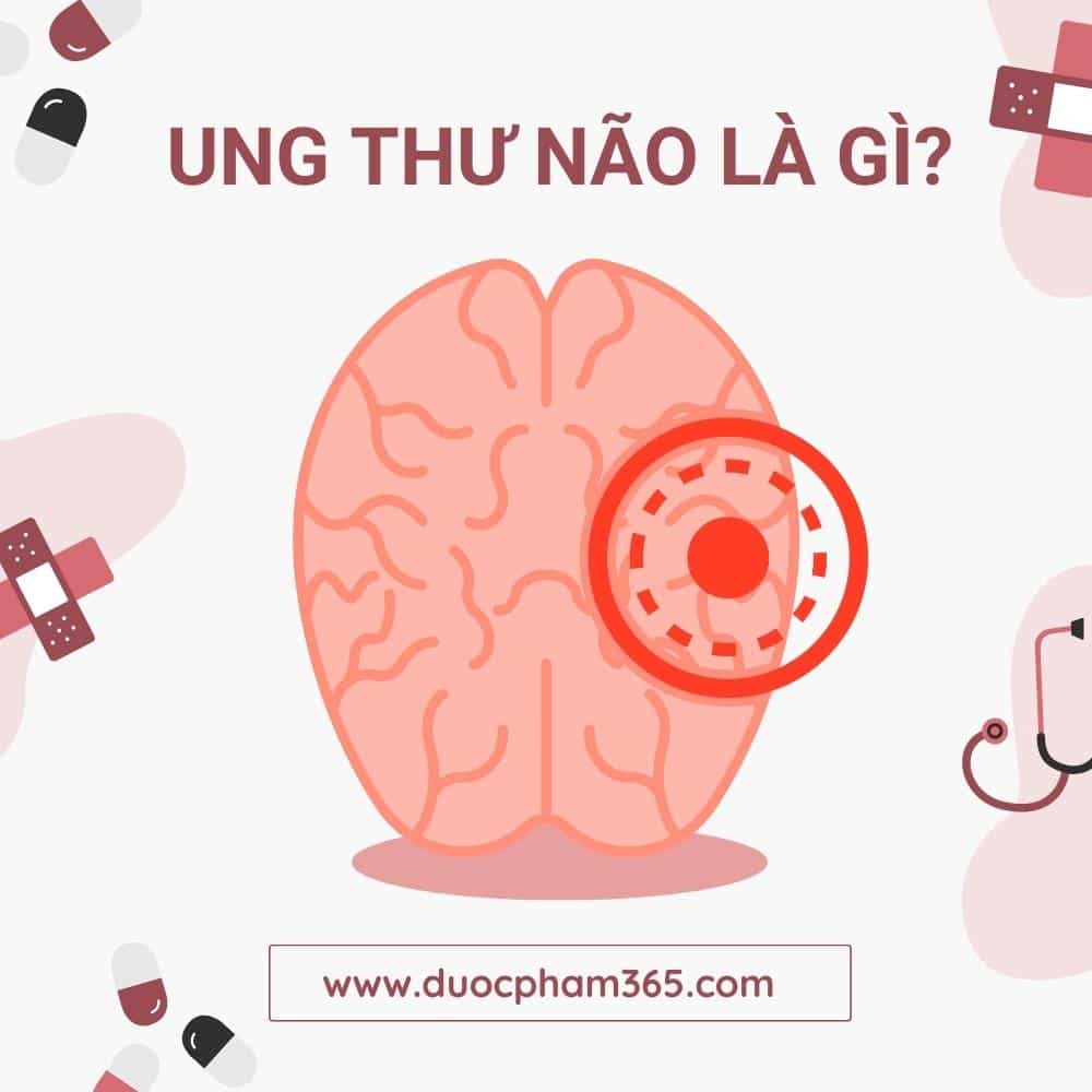 ung thư não là gì