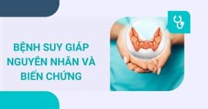 Bệnh suy giáp