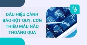 anh bia thieu mau nao thoang qua