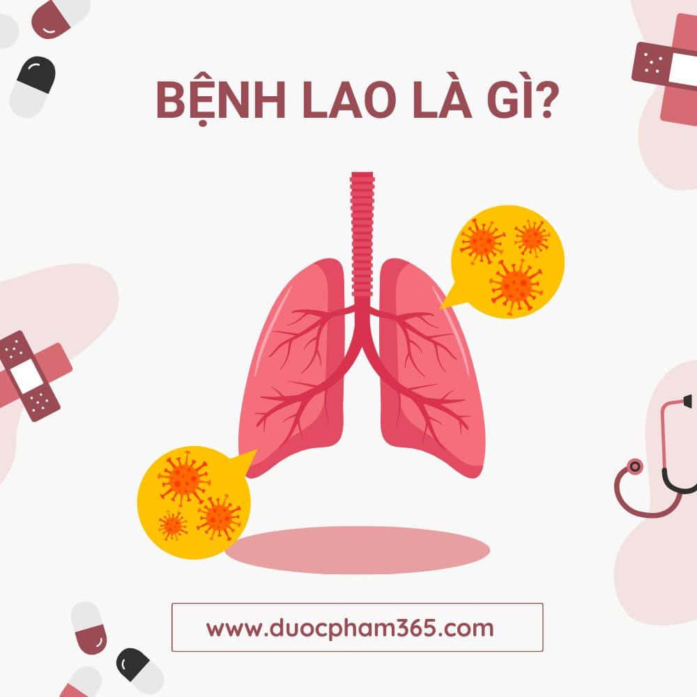 Bệnh lao - Nguyên nhân và cách điều trị 1 Bệnh lao là gì?