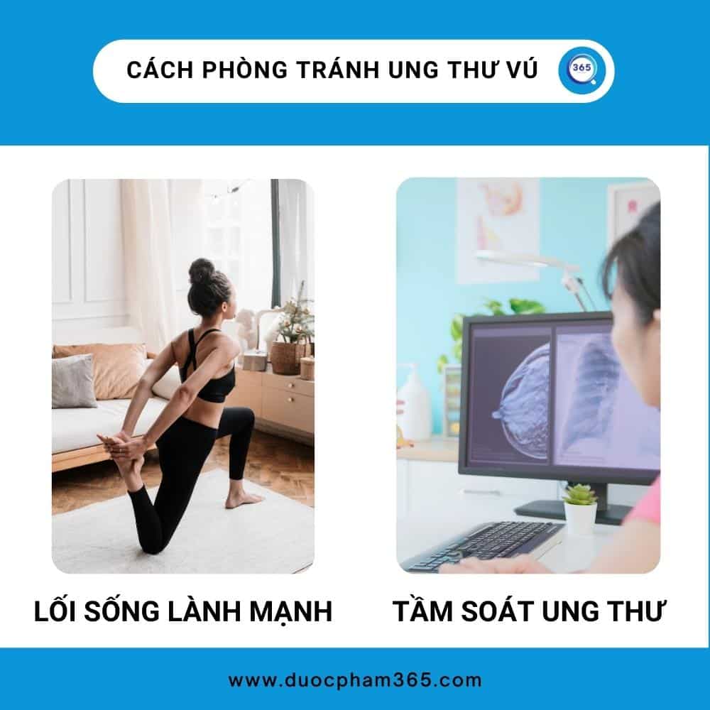Ung thư vú những điều nên biết 6 cach phong tranh ung thu vu