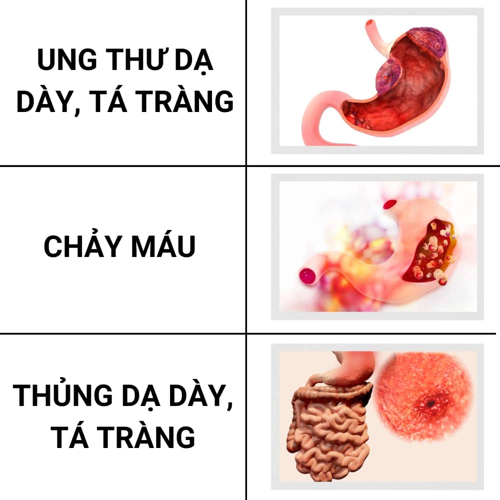 mot so bien chung viem loet da day