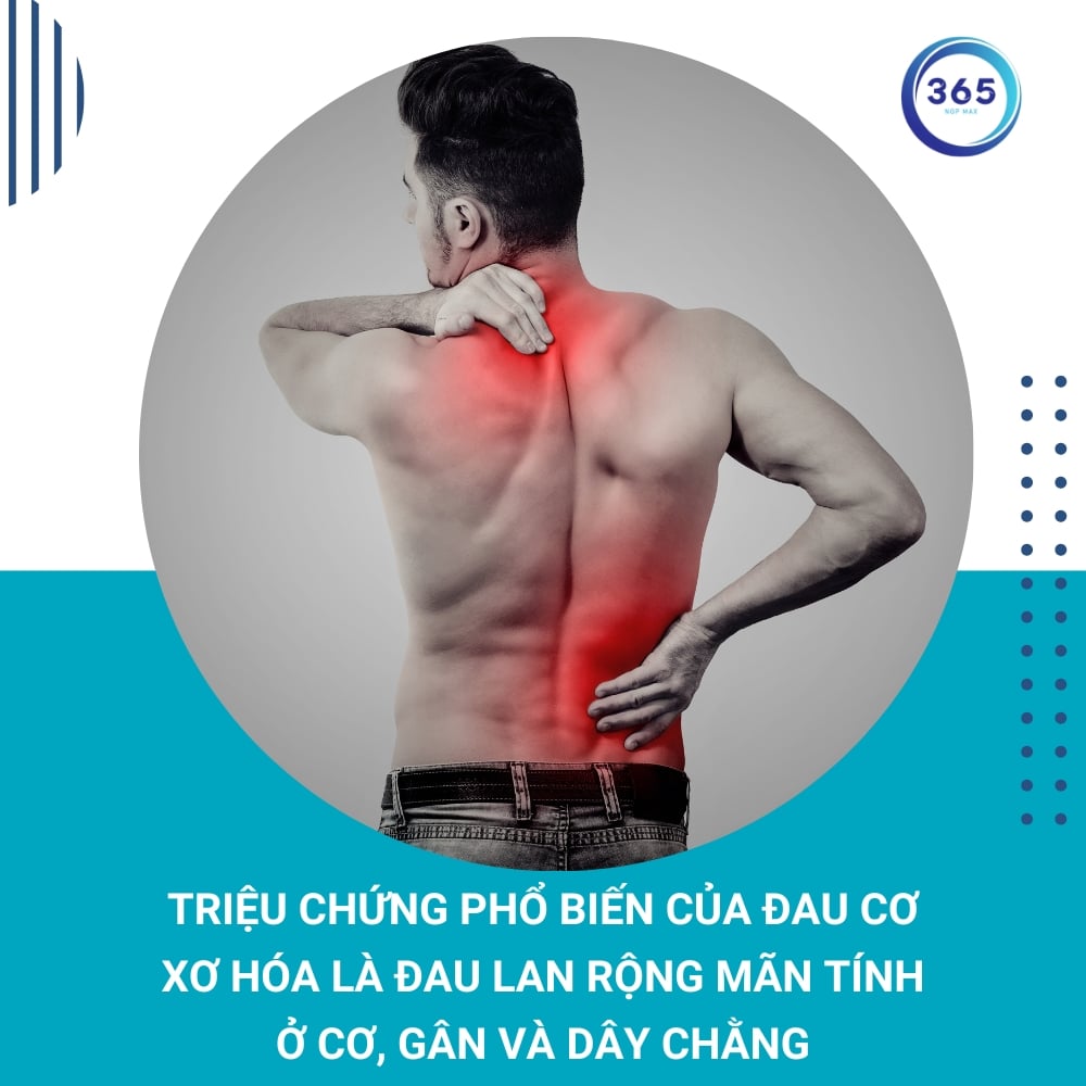 Thế nào là đau cơ xơ hóa? 1 Đau cơ xơ hóa là gì?