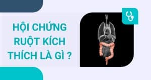 hội chứng ruột kích thích là gì?