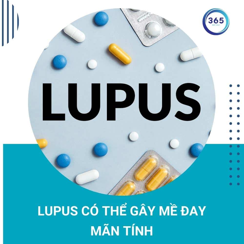 Mề đay mãn tính nguyên nhân do đâu 4 benh tu mien