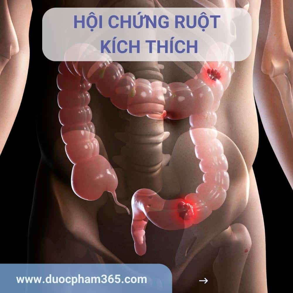 Hội chứng ruột kích thích là gì?