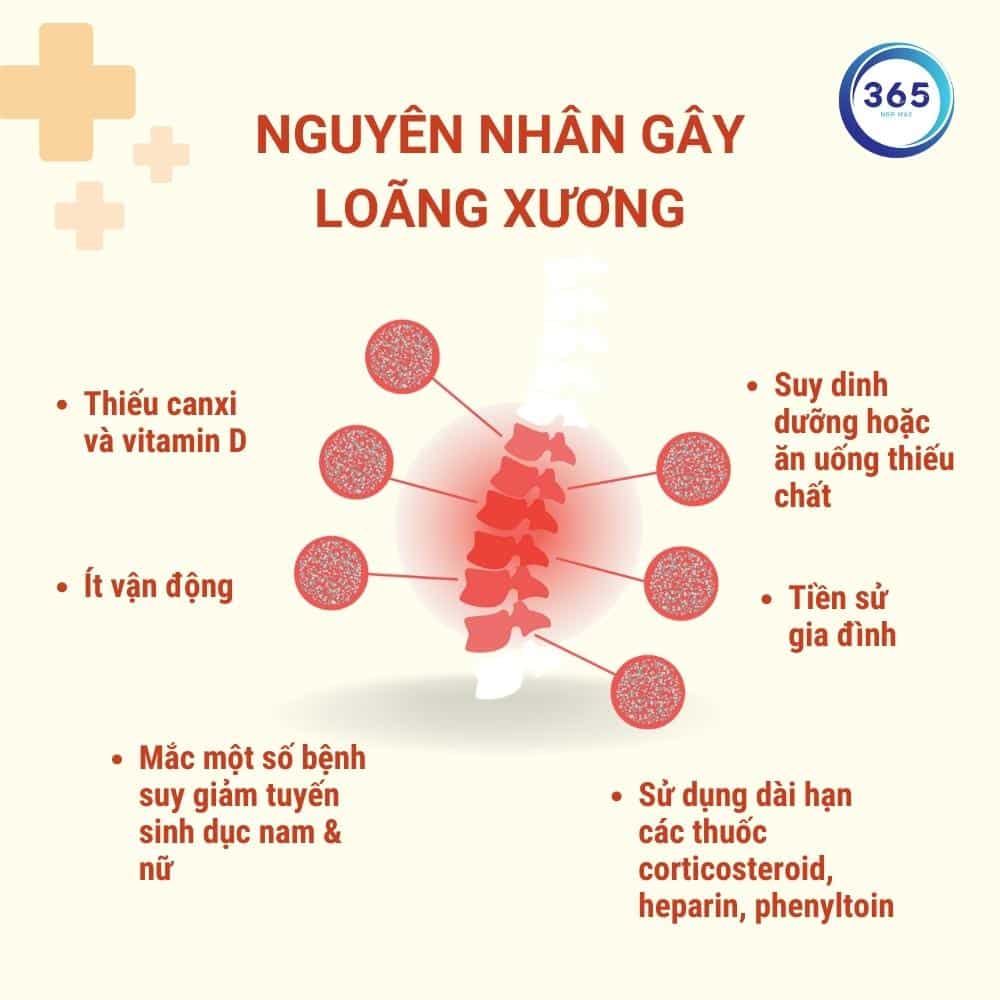 Loãng xương là gì? Ai nên kiểm tra loãng xương? 2 nguyen nhan gay loang