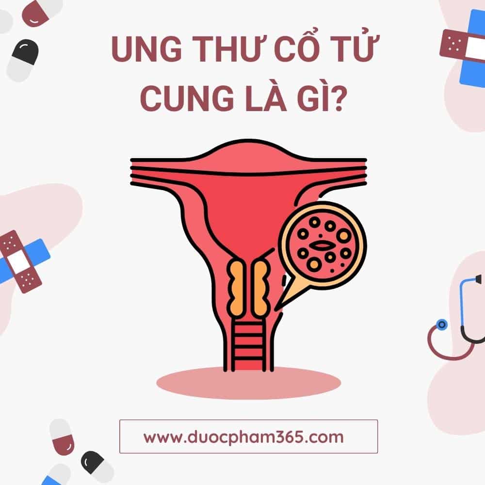 ung thu co tu cung la gi