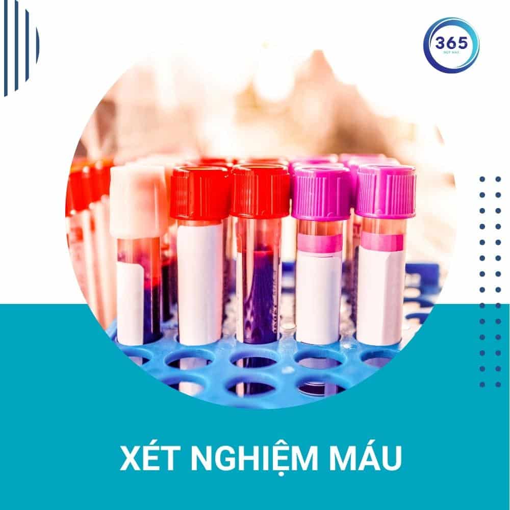 xet nghiem mau
