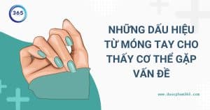 anh bia nhung dau hieu cho thay mong tay co van de