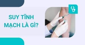 anh bia suy tinh mach la gi