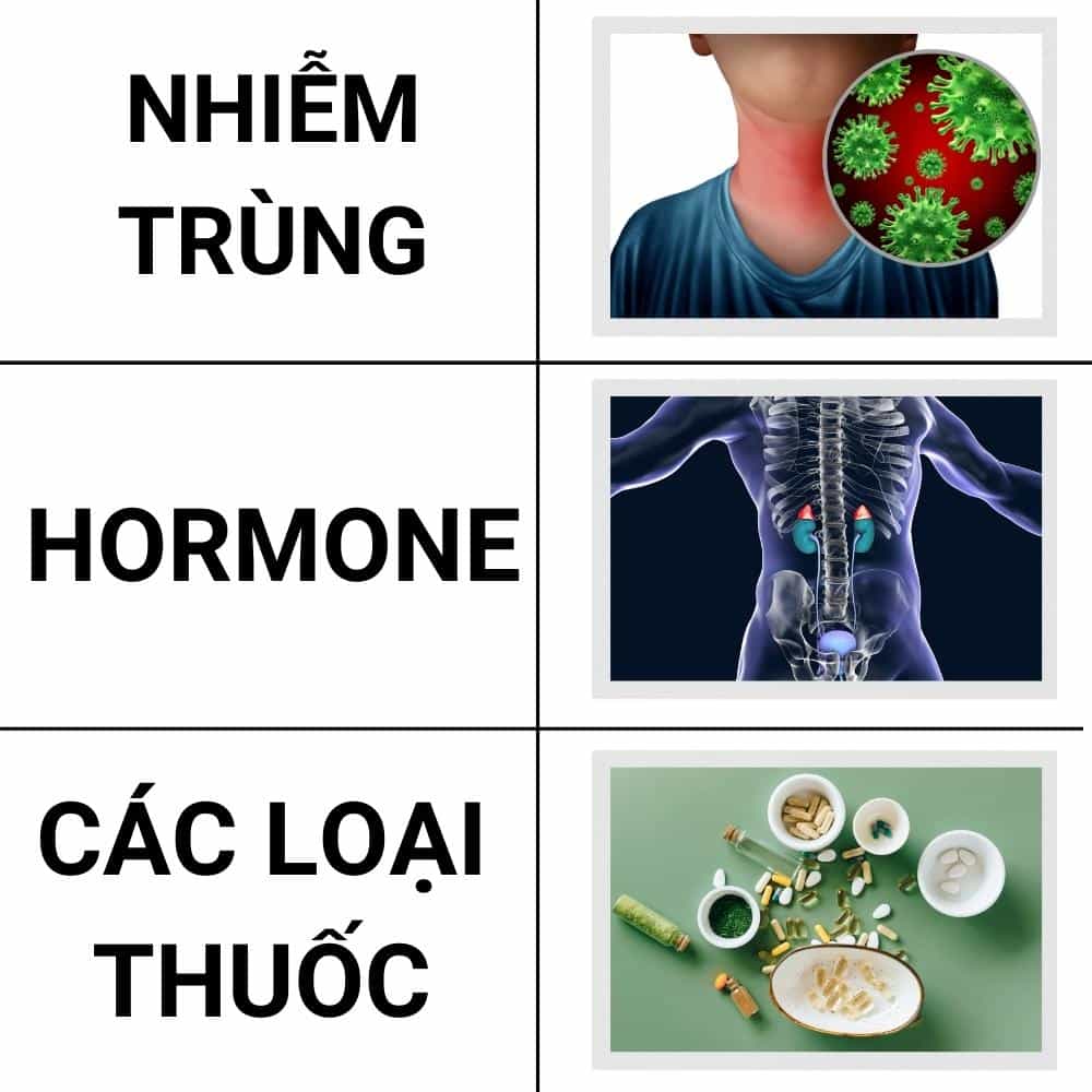 cac trieu chung benh khi do mo hoi