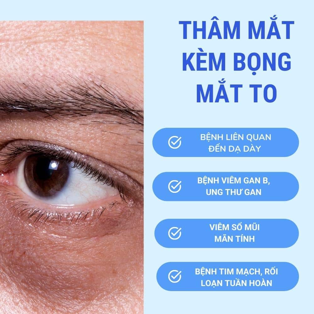 dau hieu cua tham mat