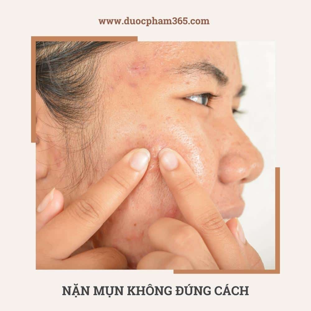 Các nguyên nhân gây mụn trứng cá thường gặp 2 nan mun khong dung cach