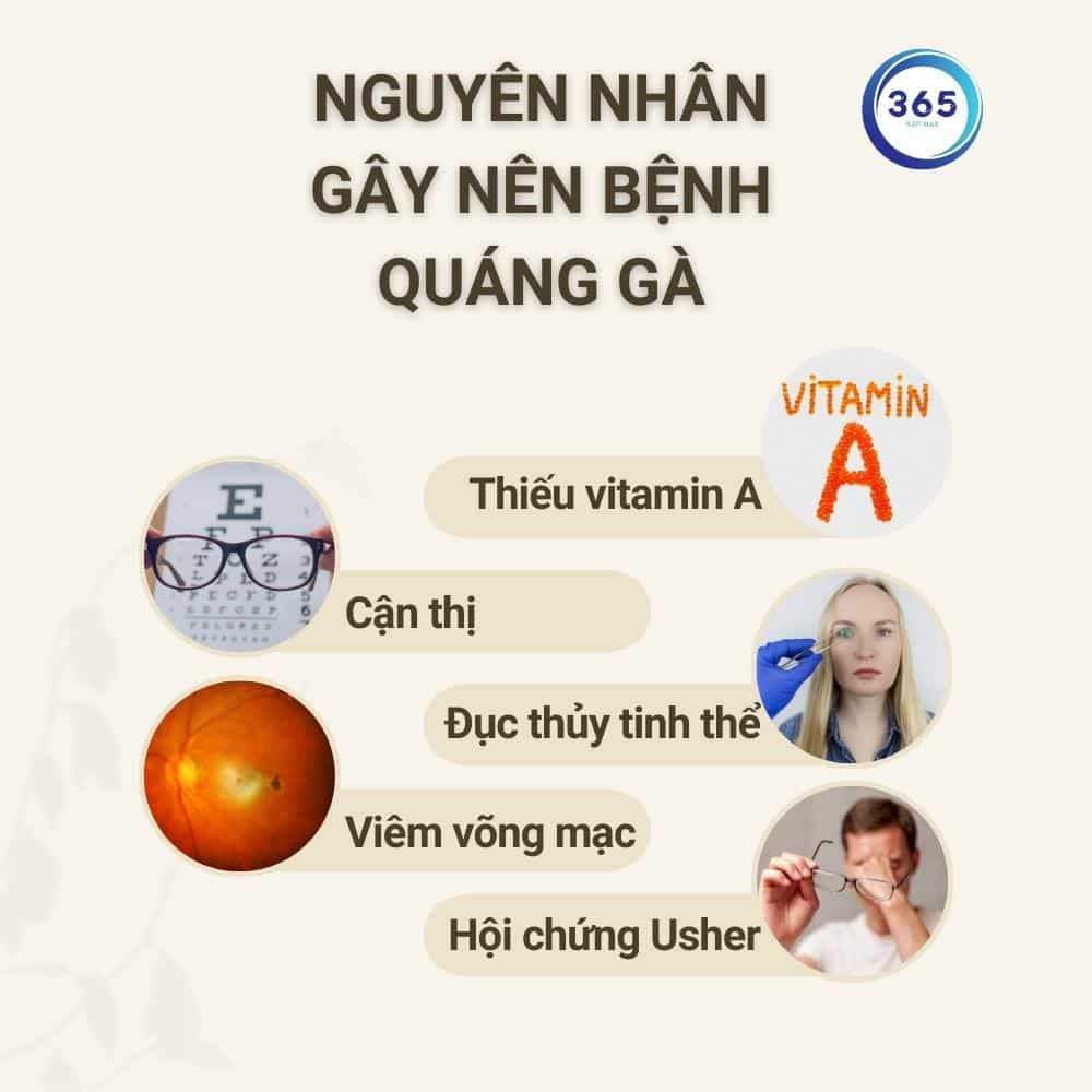 nguyen nhan gay benh quang ga