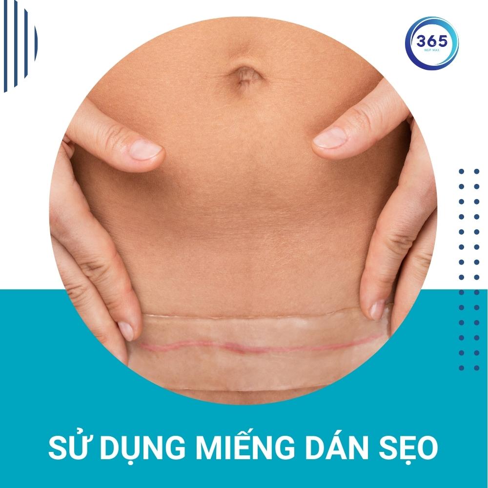 Sủ dụng miếng dán để ngăn ngừa sẹo