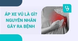 anh bia ap xe vu la gi 1