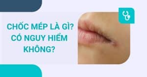 anh bia choc mep la gi