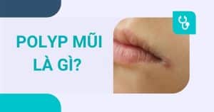 anh bia polyp mui la gi