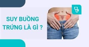anh bia suy buong trung la gi