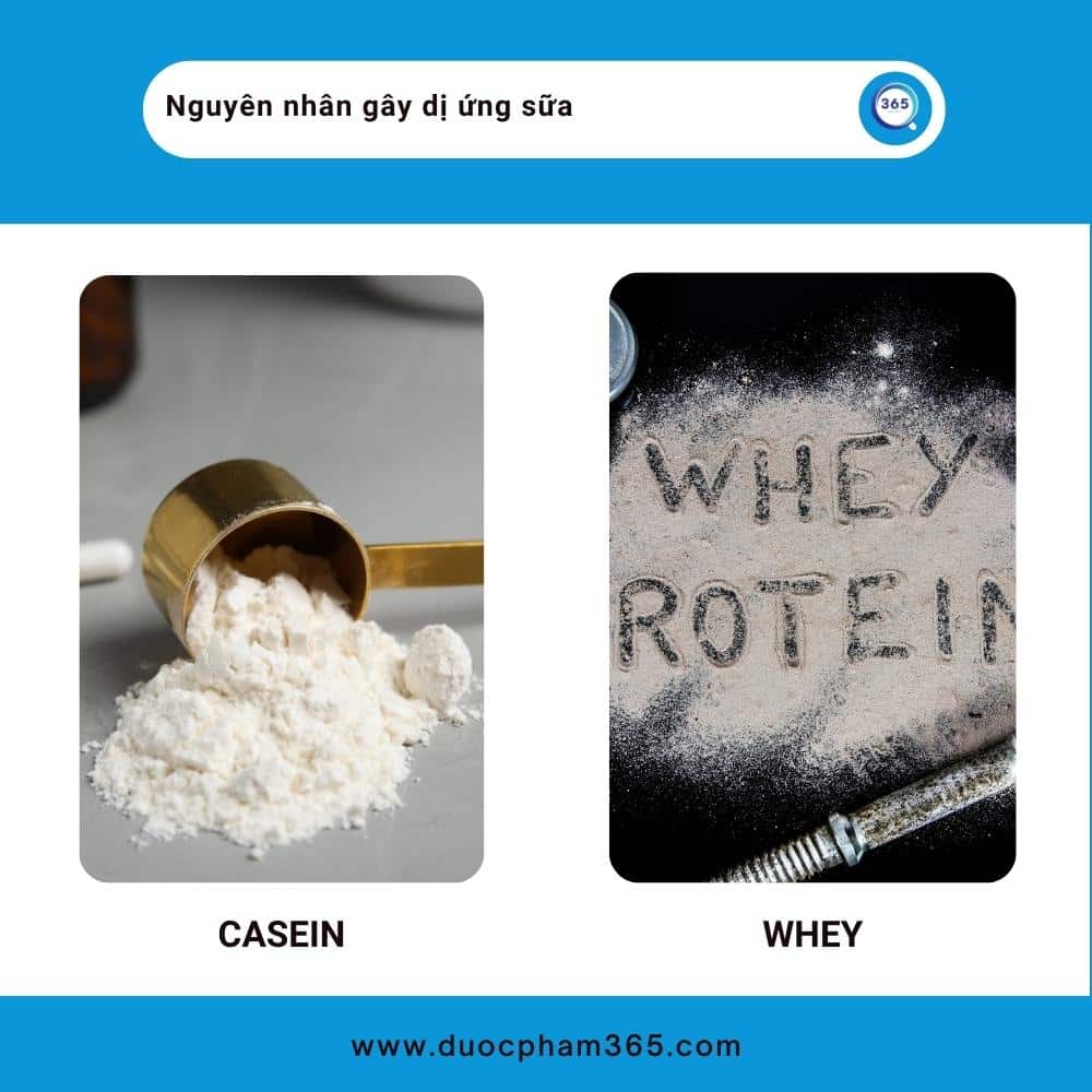 nguyen nhan di ung sua