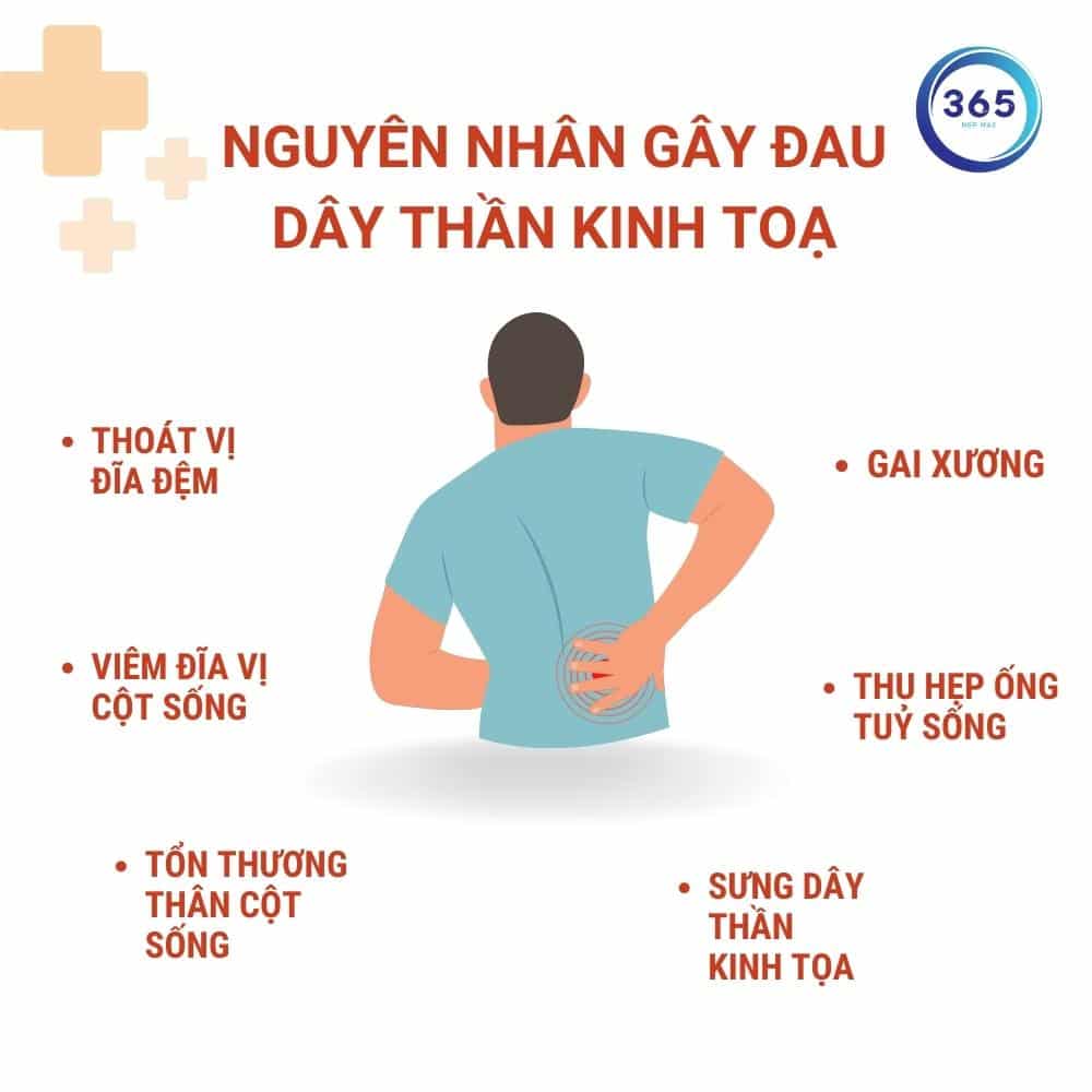 nguyen nhan gay dau than kinh toa