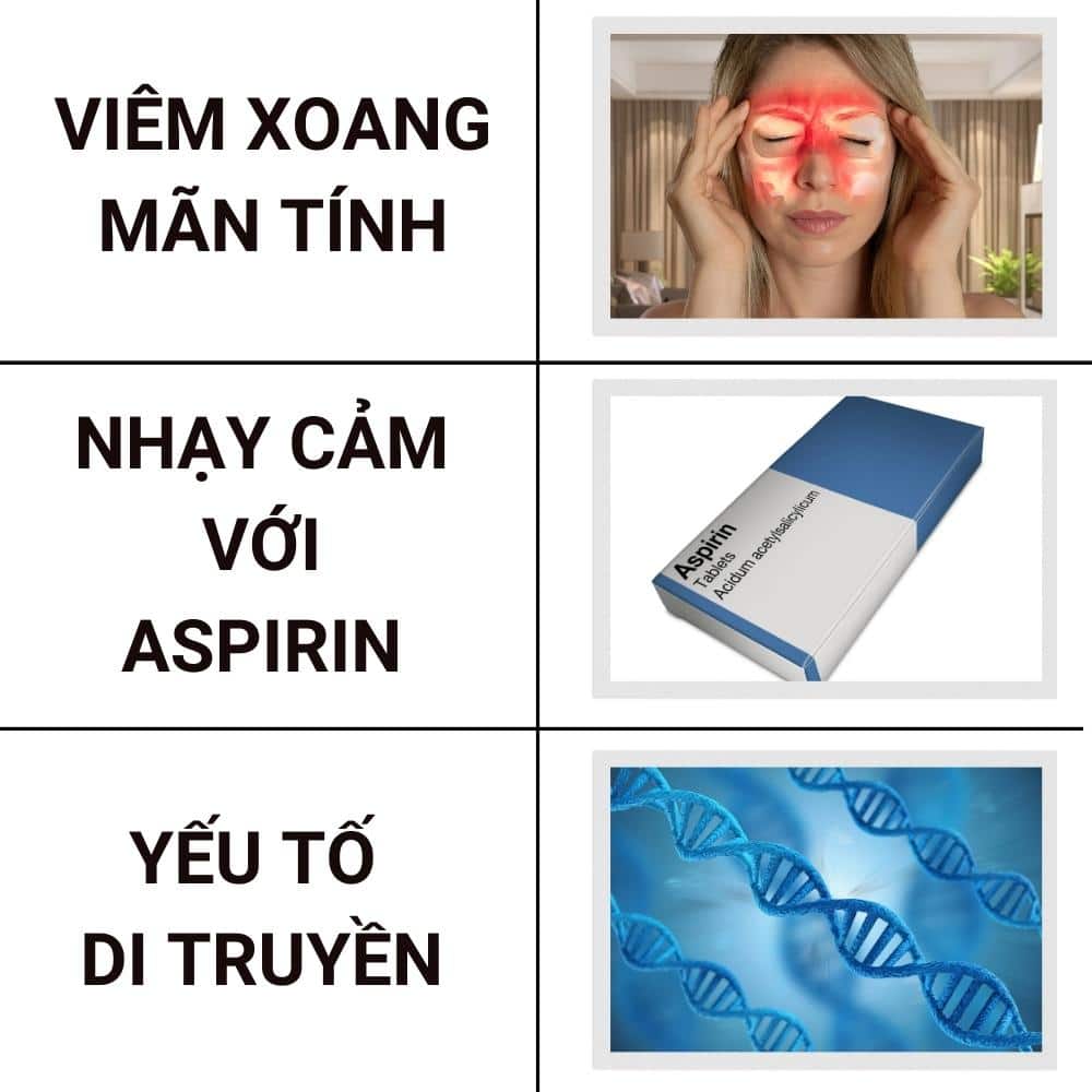 nguyen nhan gay polyp mui