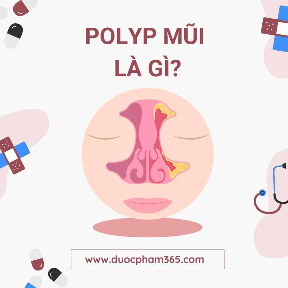 polyp mui la gi