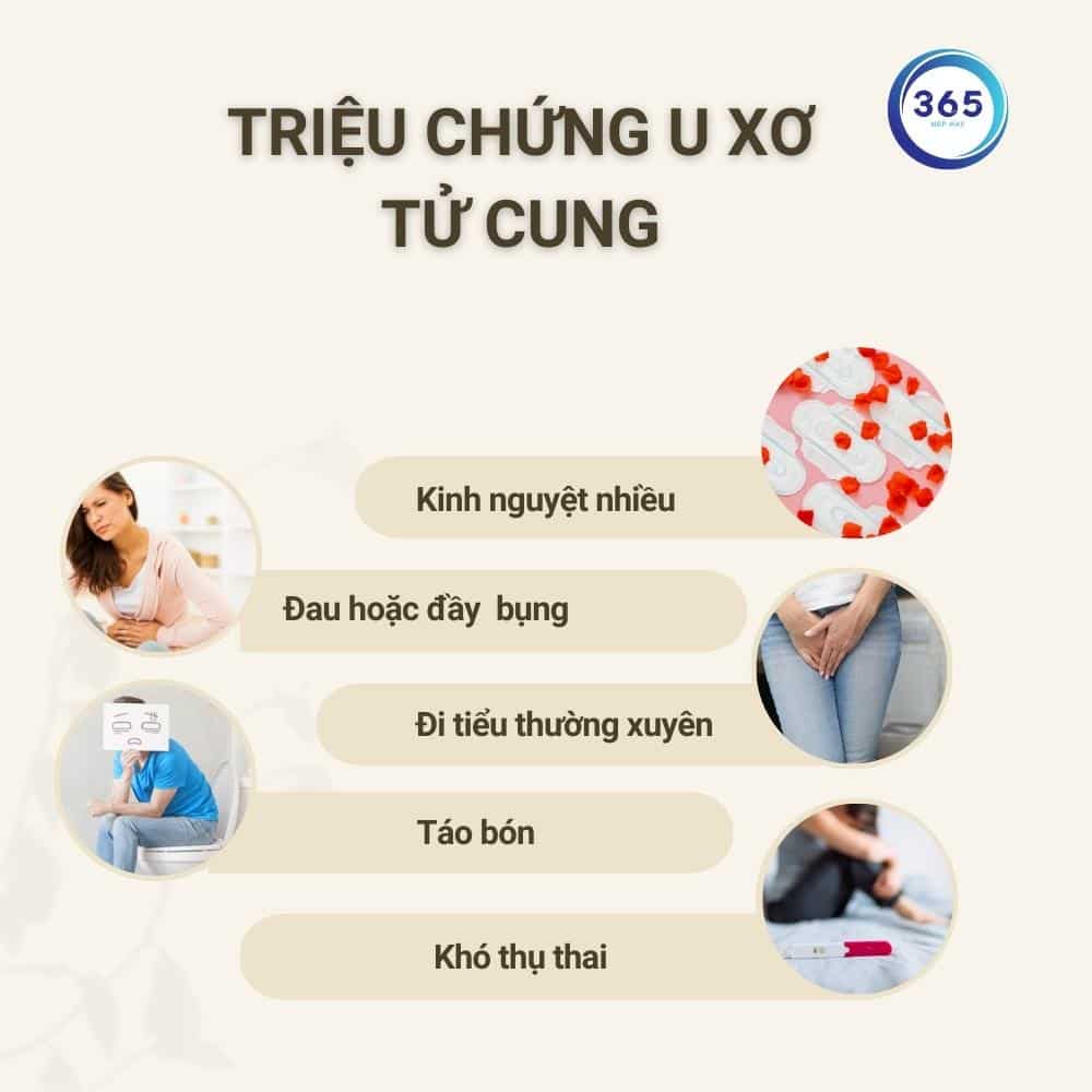 Dấu hiệu nhận biết u xơ tử cung! 2 trieu chung cua u xo tu cung
