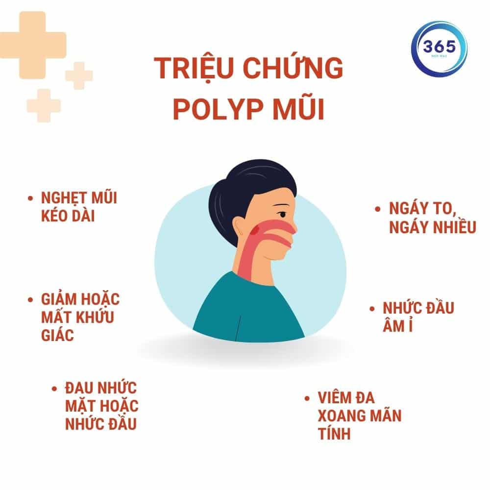 trieu chung polyp mui