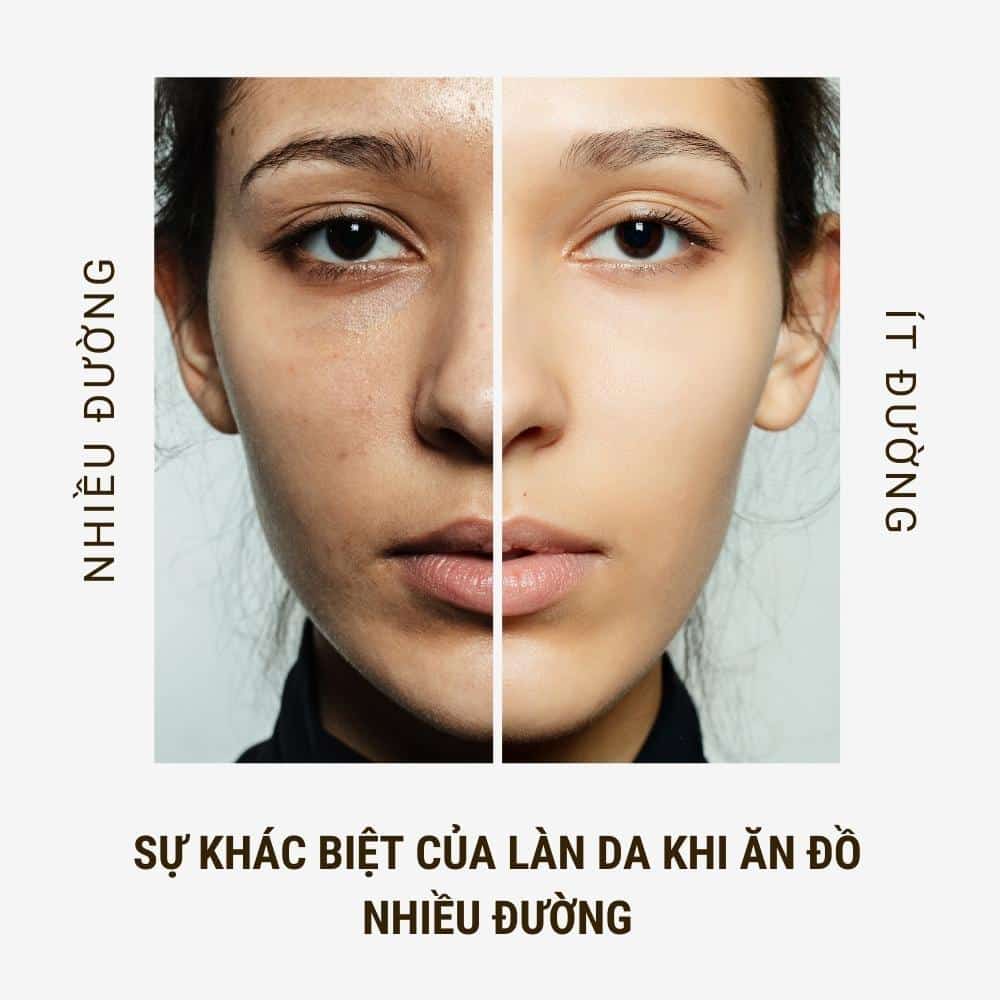 ăn nhiều đường khiến da mặt sạm đi