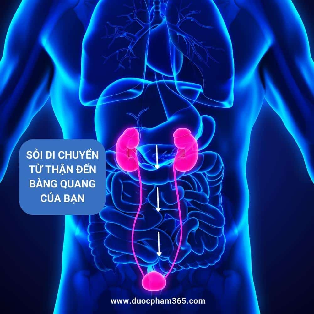 Đọc vị các cơn đau do sỏi thận 2 sỏi thận gây tắc đường tiết niệu