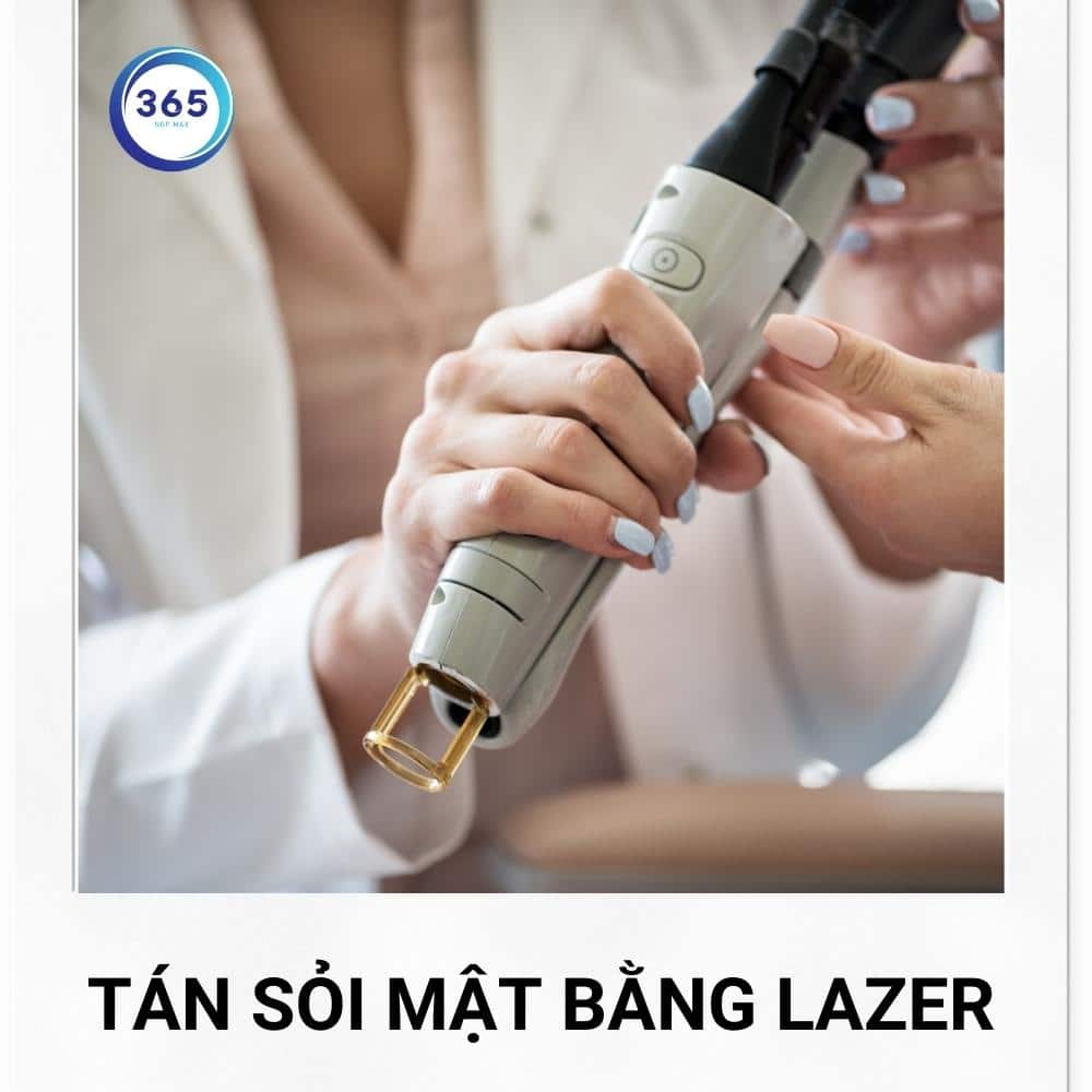 tan soi mat bang lazer