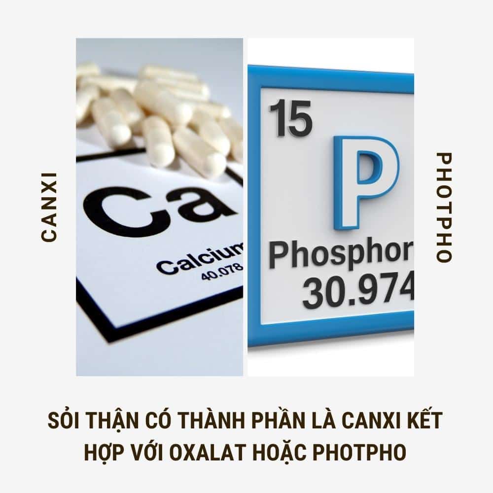 thành phần của sỏi thận