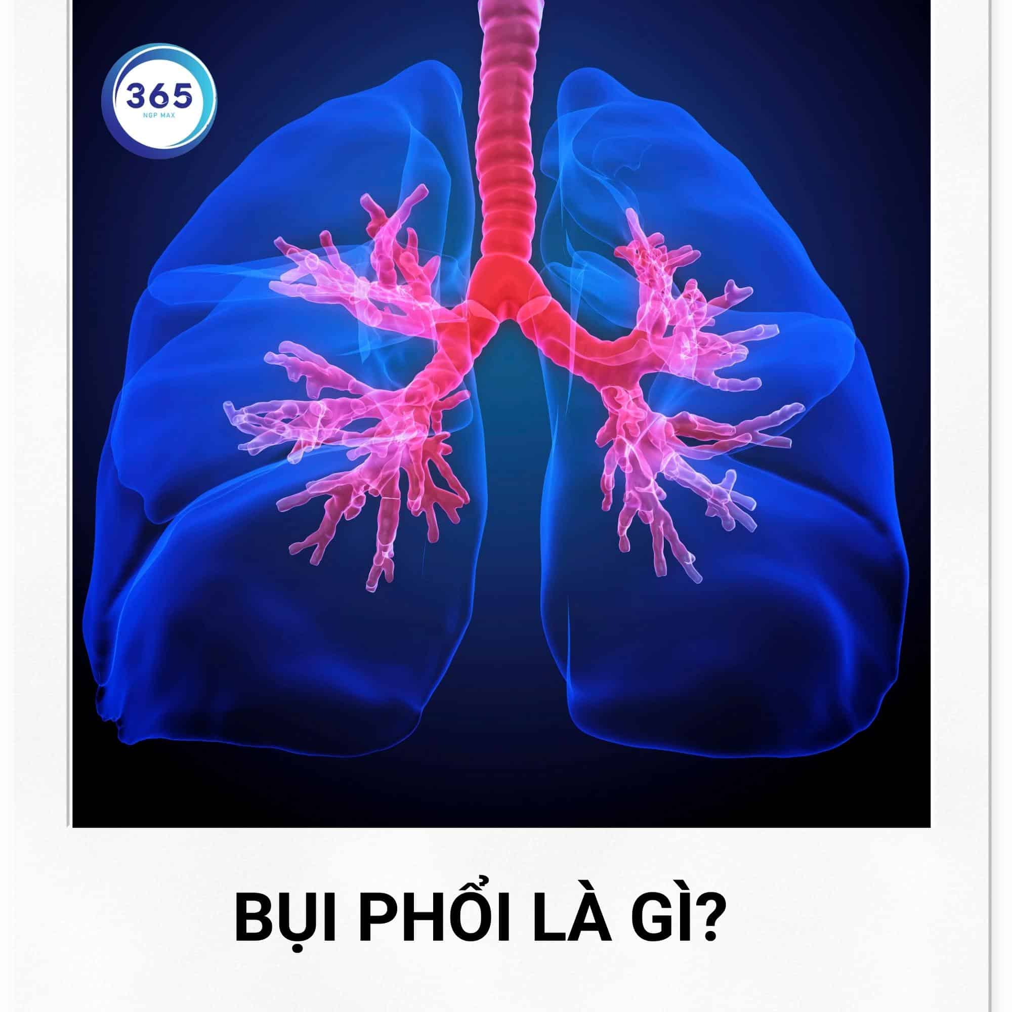Bụi phổi có nguy hiểm không? 1 bui phoi la gi