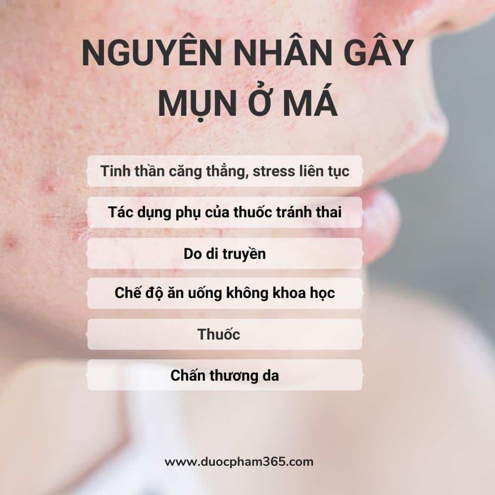 cac nguyen nhan mun o ma