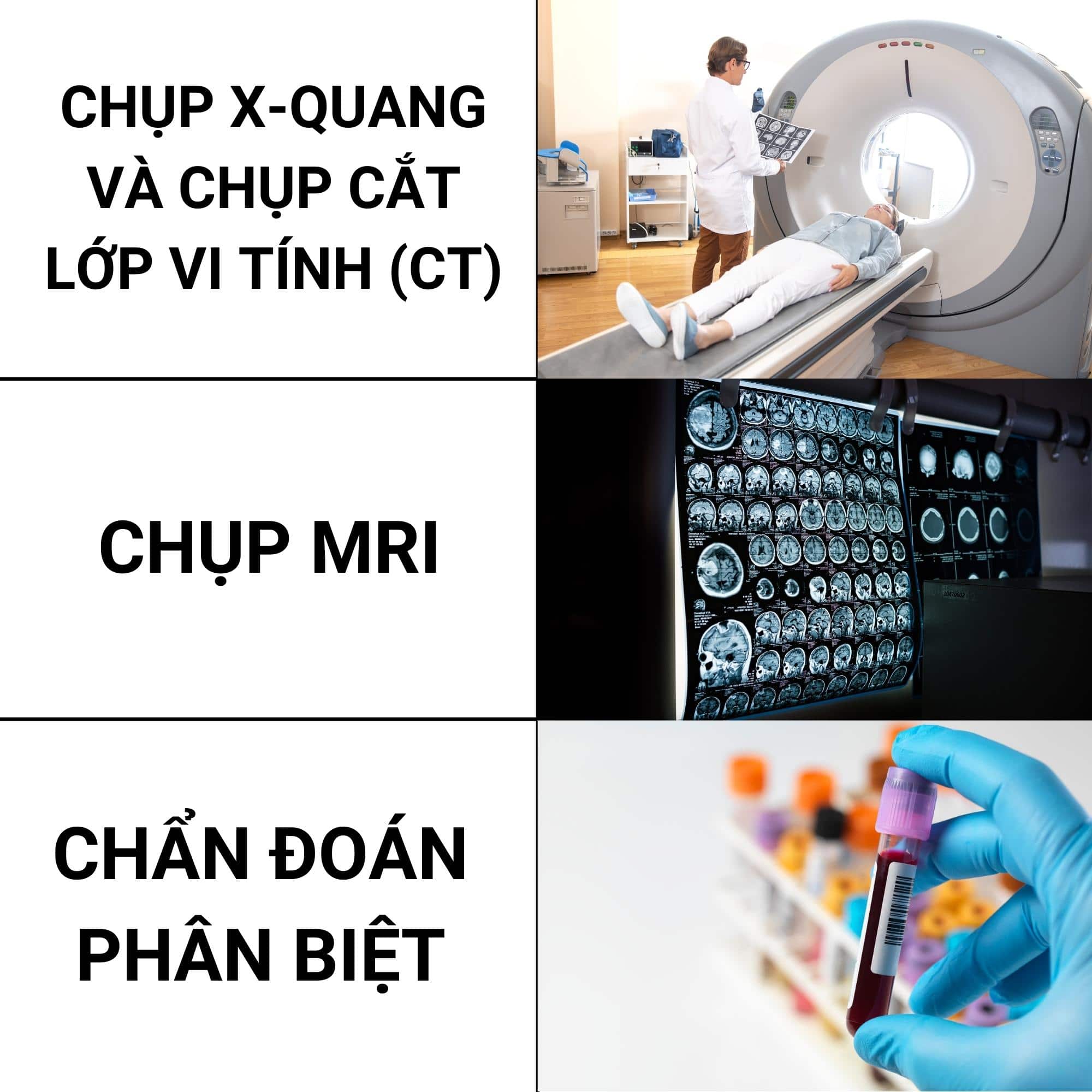 U máu có chữa được không ? 1 các phương pháp chuẩn đoán u máu