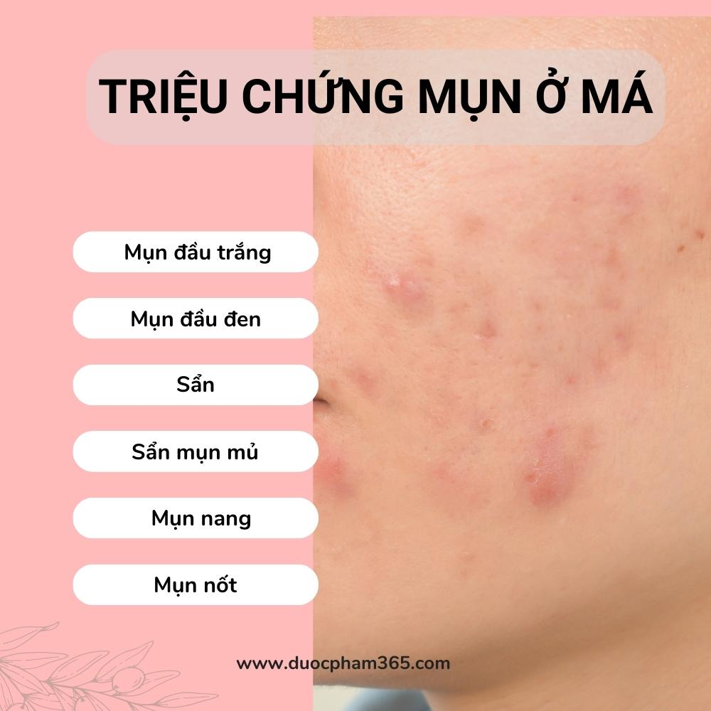 trieu chung mun o ma