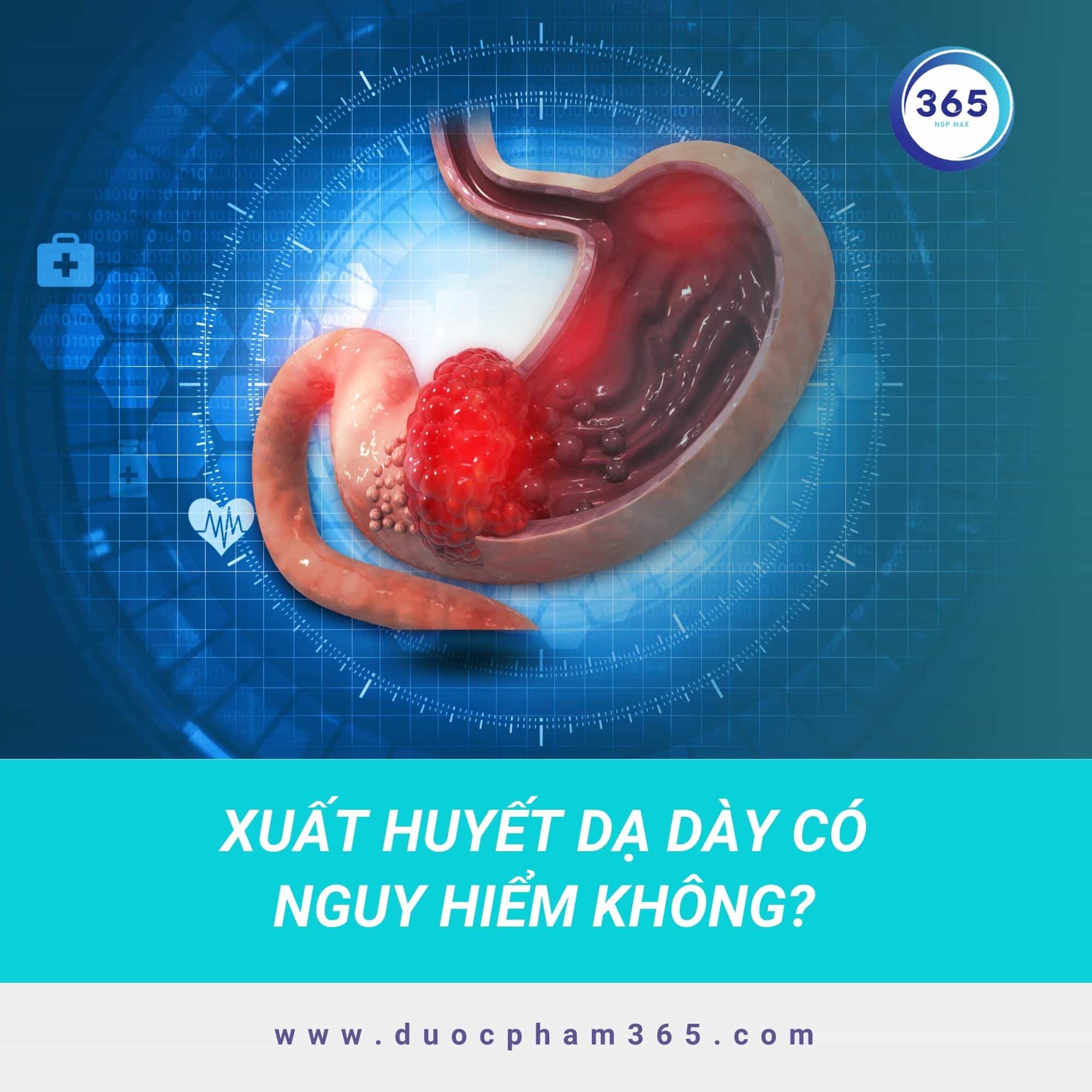 Xuất huyết dạ dày có nguy hiểm không? 1 Xuất huyết dạ dày